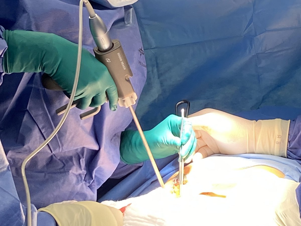 Neues Ultraschallskalpell für chirurgische Eingriffe | AMEOS Klinikum Haldensleben