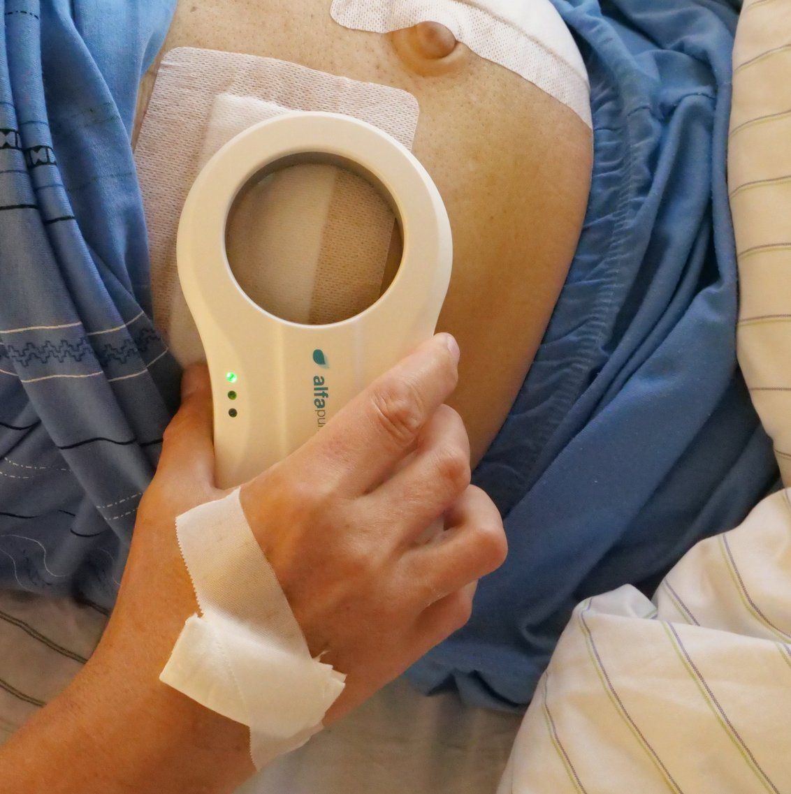 Innovatives Therapieverfahren für Lebererkrankungen
